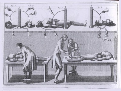 Giovanni Aldini’s experiments on the stimulation of a human corpse’s parts with the electricity of the battery. From Essai théorique et expérimentale sur le galvanisme, 1803